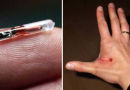 Microchip sotto pelle in arrivo per tutti?
