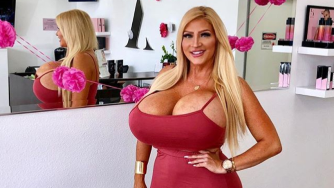 Mamma apre un sito di Crowdfunding per aiutare le donne a finanziare i loro “ritocchini”!