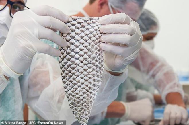 Donna Transgender diventa la prima al mondo a ricevere una vagina realizzata con pelle di pesce!