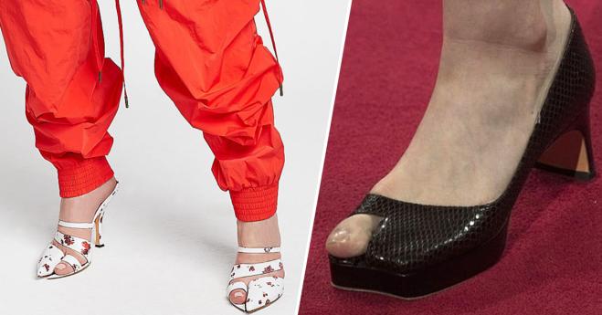 Nuova moda del momento: arrivano le scarpe “alluce”!