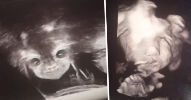  La terrificante ecografia del bambino che ha terrorizzato la madre!