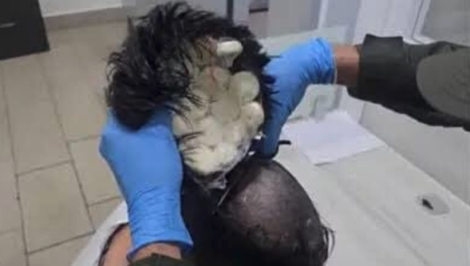 Nasconde la cocaina sotto al parrucchino