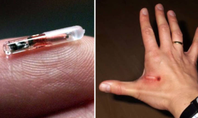 Microchip sotto pelle in arrivo per tutti?