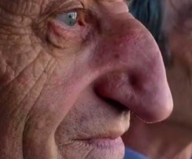 Più di 8 cm per il naso più lungo al mondo