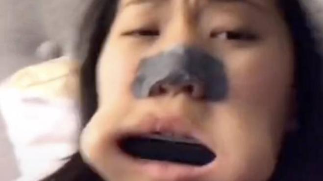 Utente di Tik Tok si è ritrovata con un'armonica bloccata in bocca!